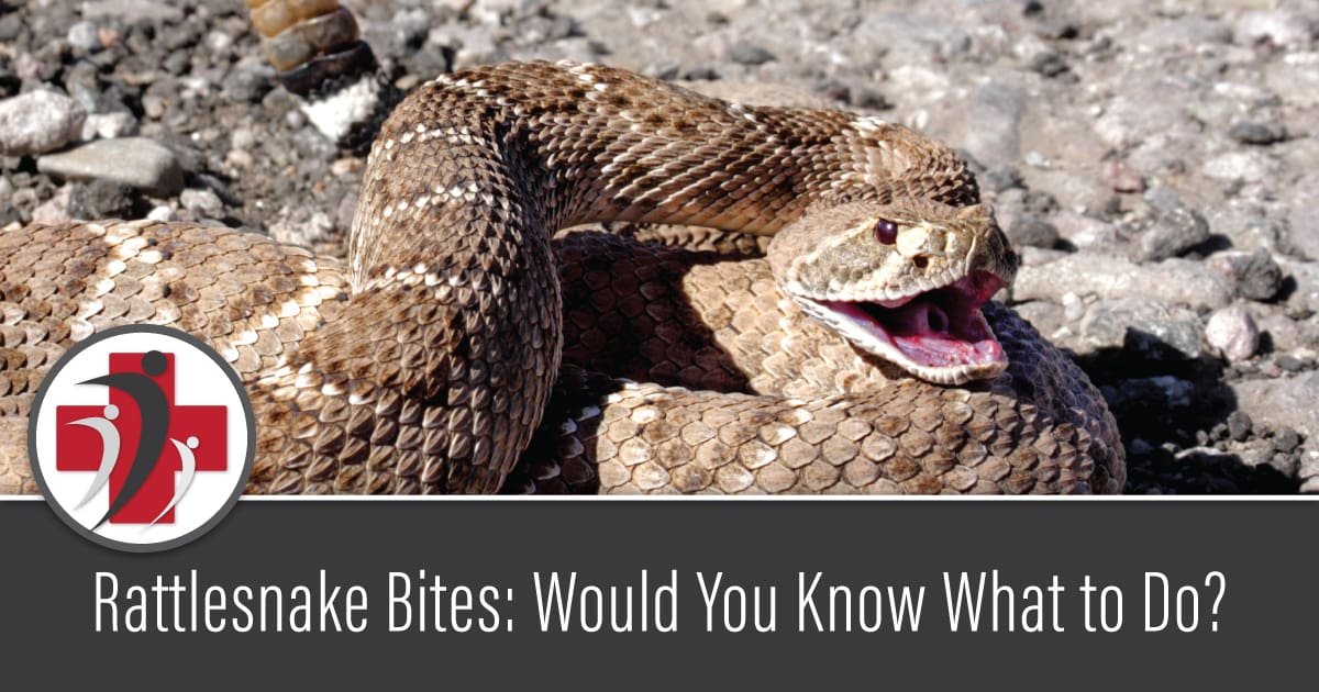 Rattlesnake Bites: Would You Know What to Do?