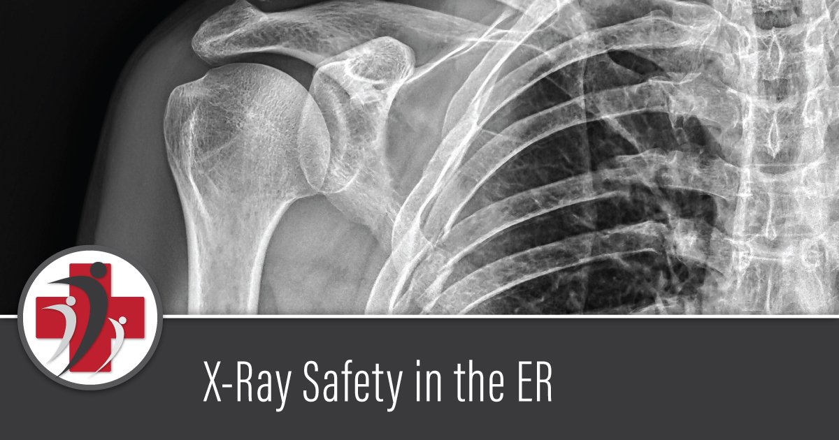 X-Ray Safety in the ER: What Patients Should Know 